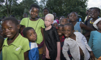 Malaví: Máttvana réttarkerfi ýtir undir árásir á fólk með albínisma